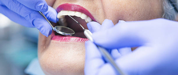 Best Emergency Dental Extractions in St Henry, OH